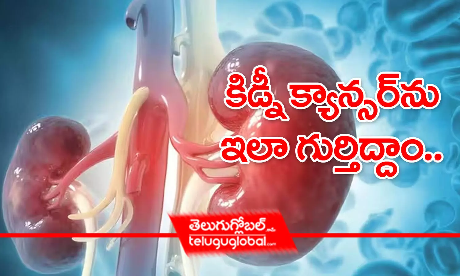 కిడ్నీ క్యాన్సర్‌ను ఇలా గుర్తిద్దాం..