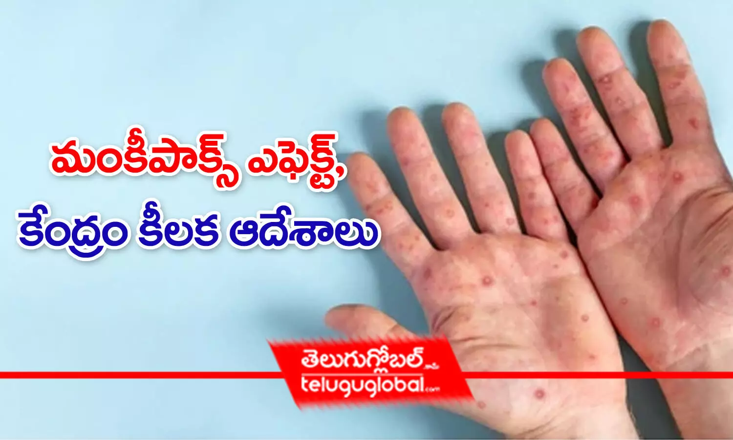 మంకీపాక్స్ ఎఫెక్ట్‌, కేంద్రం కీలక ఆదేశాలు