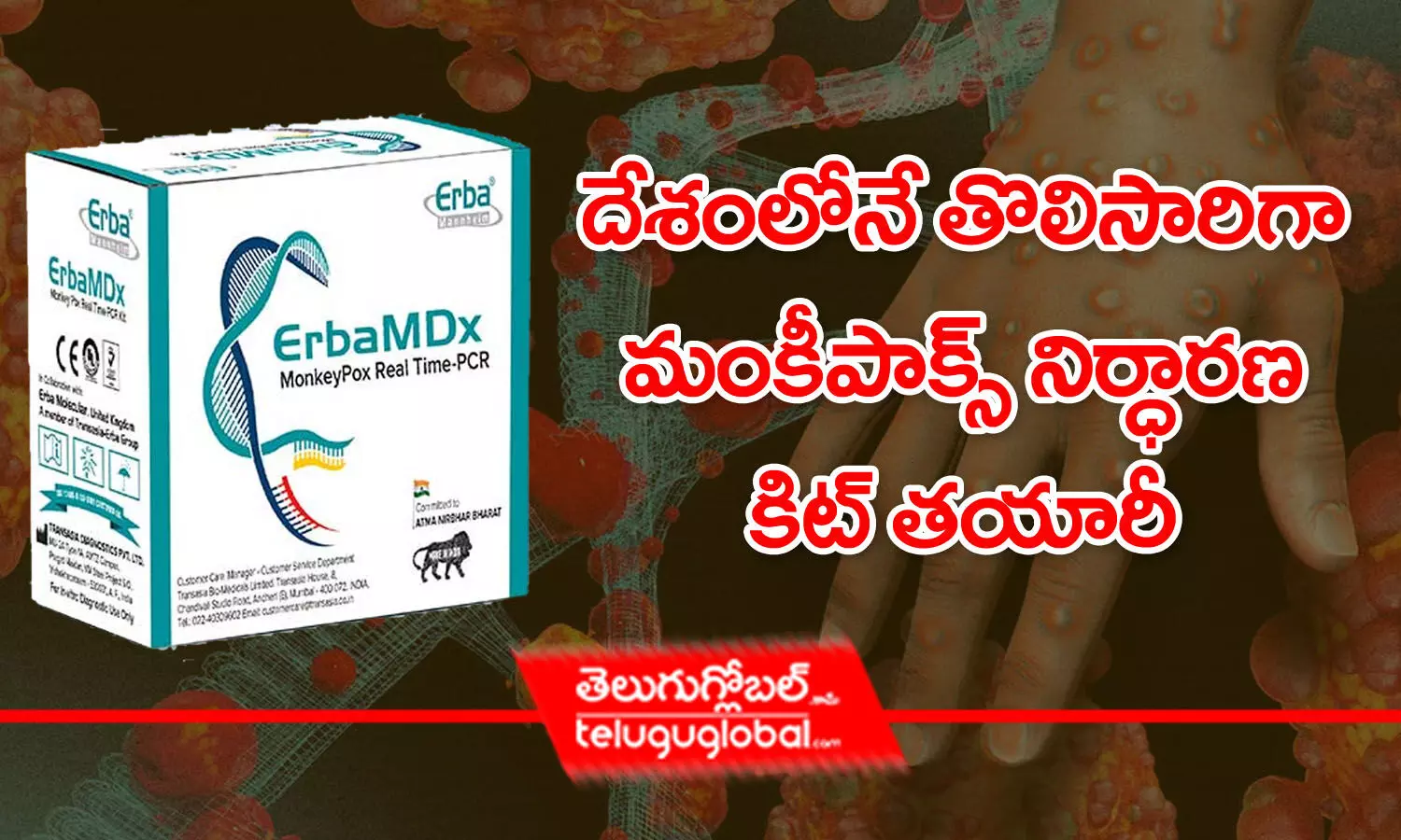 దేశంలోనే తొలిసారిగా మంకీ పాక్స్‌ నిర్ధారణ కిట్‌ తయారీ