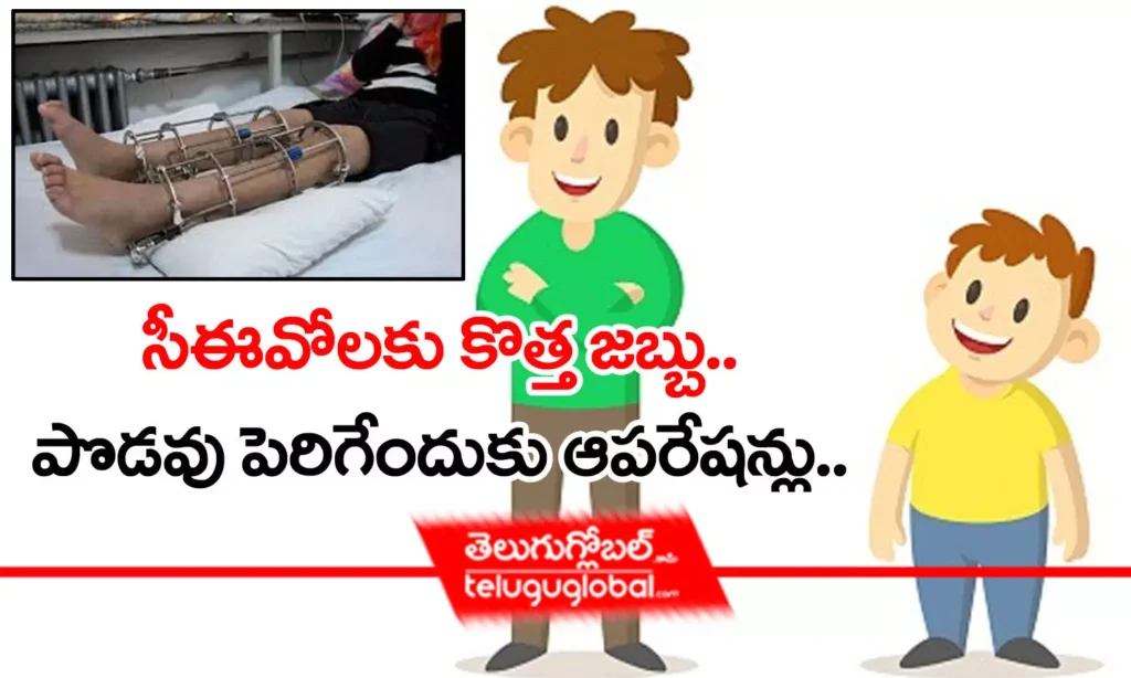 సీఈవోలకు కొత్త జబ్బు.. పొడవు పెరిగేందుకు ఆపరేషన్లు...