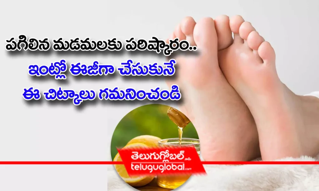 పగిలిన మడమలకు పరిష్కారం.. ఇంట్లో ఈజీగా చేసుకునే ఈ చిట్కాలు గమనించండి