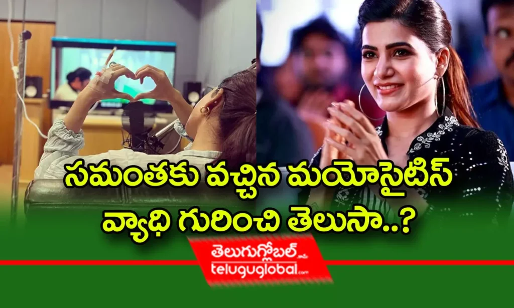 సమంతకు వచ్చిన మయోసైటిస్ వ్యాధి గురించి తెలుసా..?