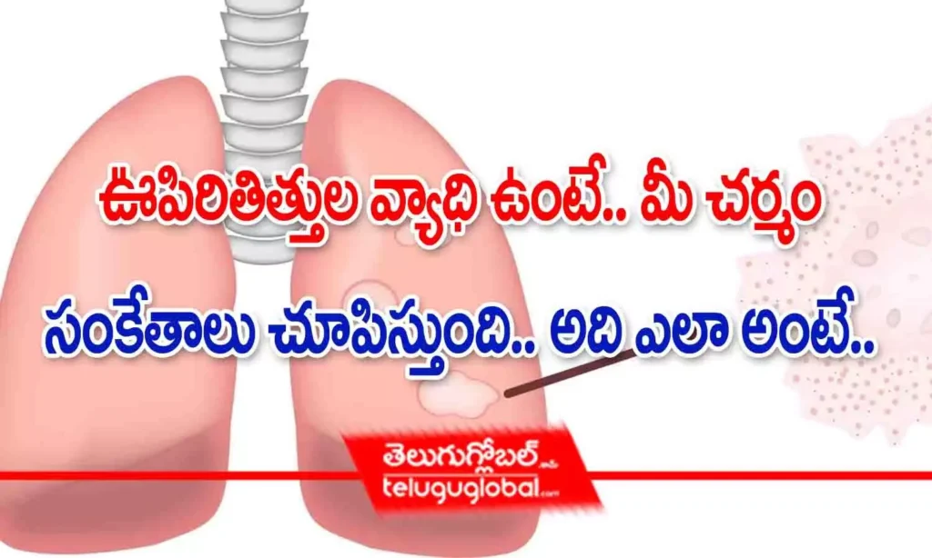 ఊపిరితిత్తుల వ్యాధి ఉంటే.. మీ చర్మం సంకేతాలు చూపిస్తుంది.. అది ఎలా అంటే
