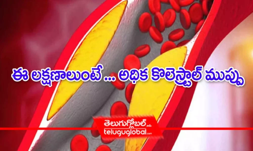 ఈ లక్షణాలుంటే ... అధిక కొలెస్ట్రాల్ ముప్పు