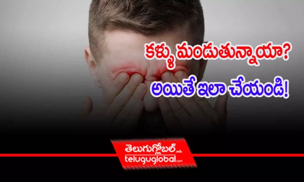 కళ్ళు మండుతున్నాయా? అయితే ఇలా చేయండి!
