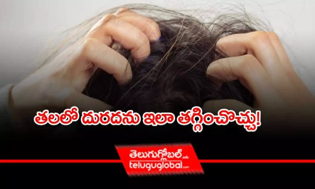 తలలో దురదను ఇలా తగ్గించొచ్చు!