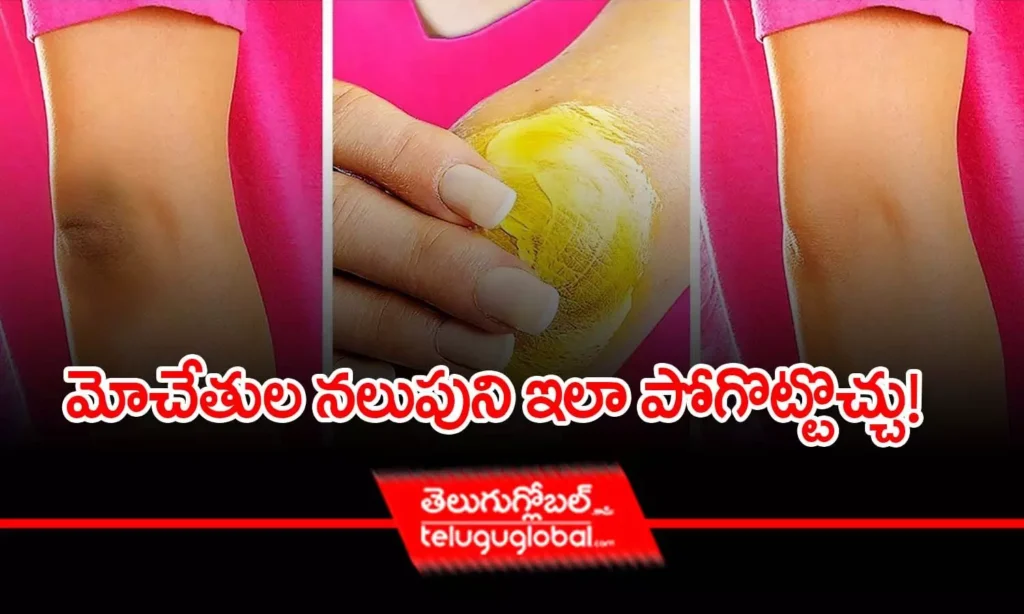 మోచేతుల నలుపుని ఇలా పోగొట్టొచ్చు!