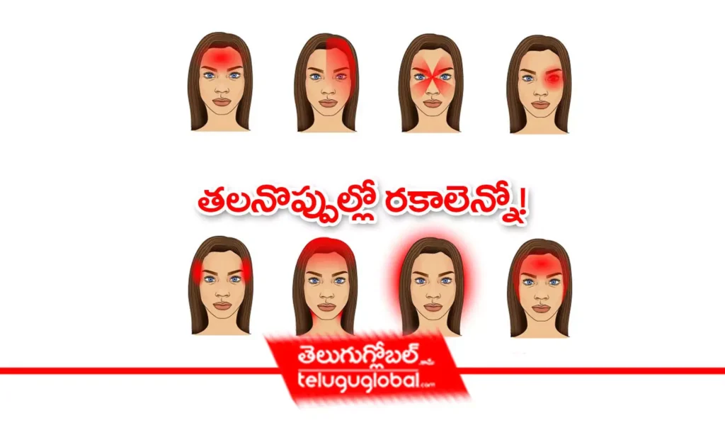 తలనొప్పుల్లో రకాలెన్నో!