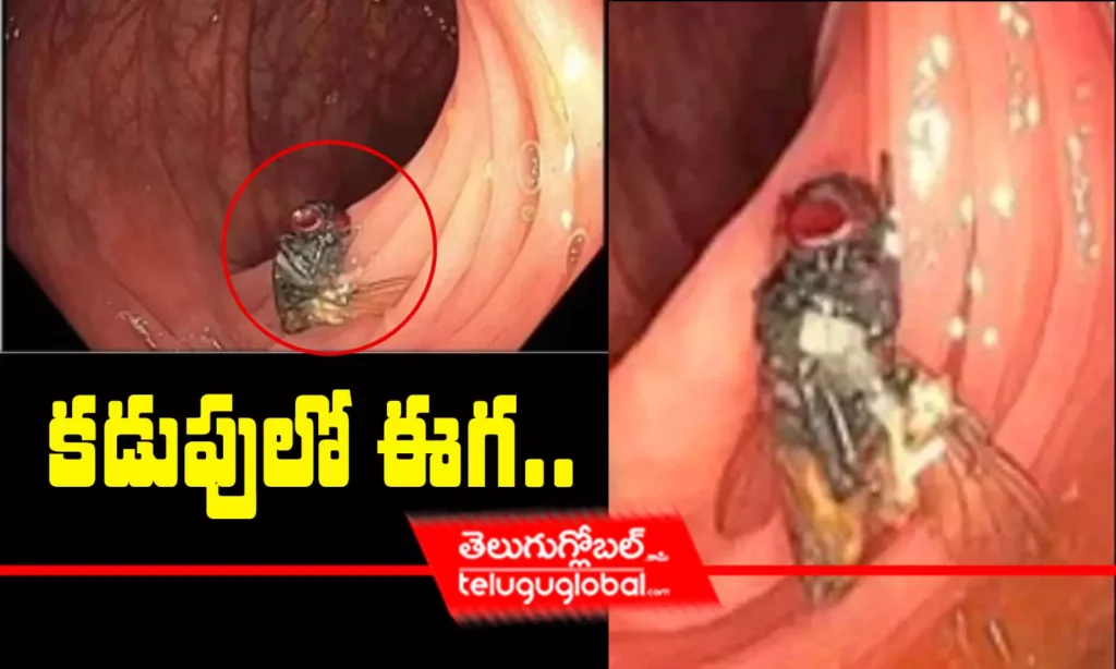 క‌డుపులో ఈగ‌..
